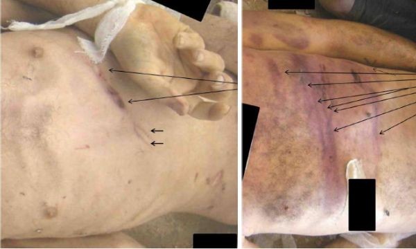 �lerlemek �&ccedil;in L&uuml;tfen Foto�raf�n &Uuml;zerine T�klay�n�z >>